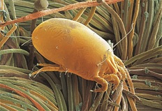 dust mite magnified 40x