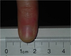 Pinky Finger