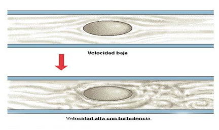 Velicidad alta con turnulencia